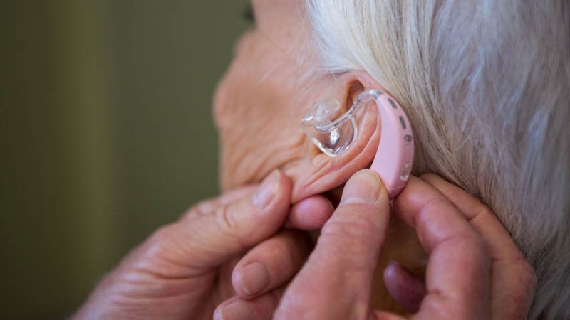 کم شنوایی حسی عصبی چگونه است؟
