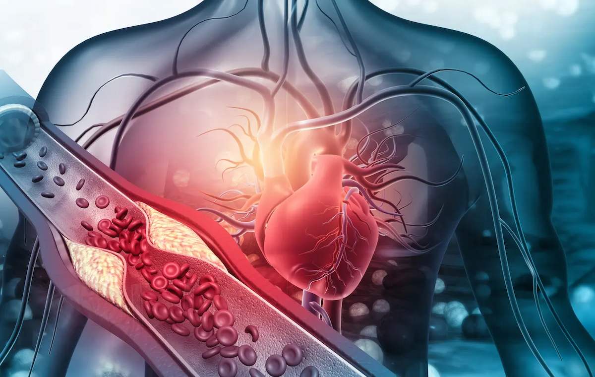 وزوز گوش ضربانی چیست؟