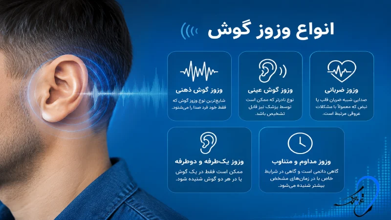 انواع وزوز گوش